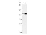 ACTN2 Polyclonal Antibody Store at -20°C - MSE Supplies LLC