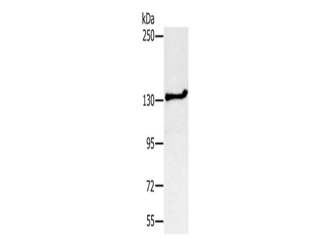 NEMF Polyclonal Antibody Store at -20°C - MSE Supplies LLC