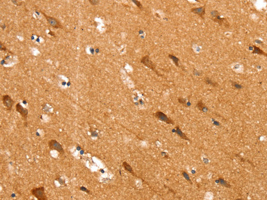 SLC25A12 Polyclonal Antibody Store at -20°C - MSE Supplies LLC