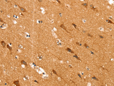 SLC25A12 Polyclonal Antibody Store at -20°C - MSE Supplies LLC