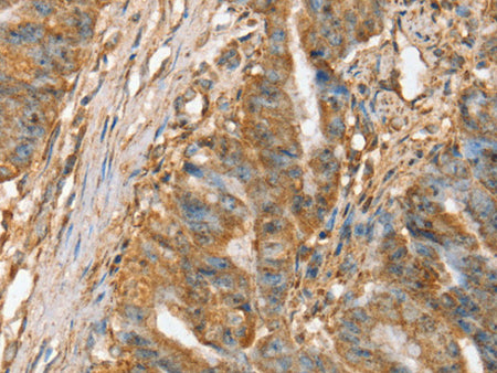 SLC41A2 Polyclonal Antibody Store at -20°C - MSE Supplies LLC