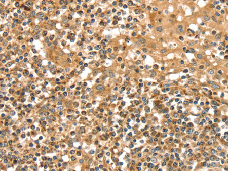 SLC8A3 Polyclonal Antibody Store at -20°C - MSE Supplies LLC