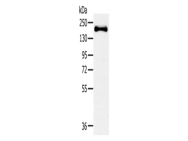 SLIT2 Polyclonal Antibody Store at -20°C - MSE Supplies LLC
