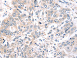 ROR1 Polyclonal Antibody Store at -20°C - MSE Supplies LLC