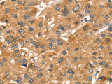 SPTAN1 Polyclonal Antibody Store at -20°C - MSE Supplies LLC