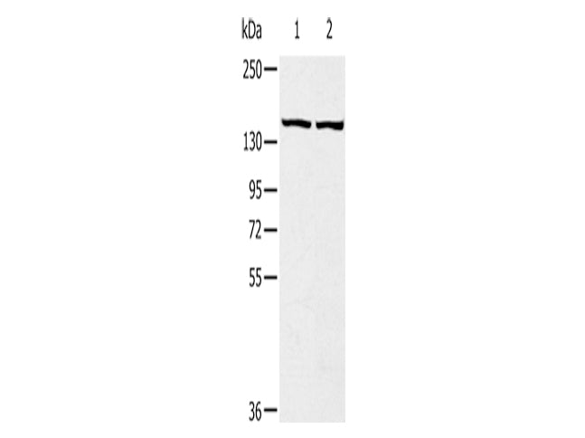 TBC1D4 Polyclonal Antibody Store at -20°C - MSE Supplies LLC