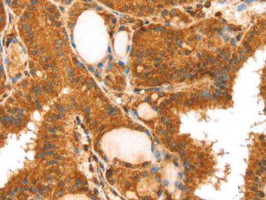 TRIM25 Polyclonal Antibody Store at -20°C - MSE Supplies LLC