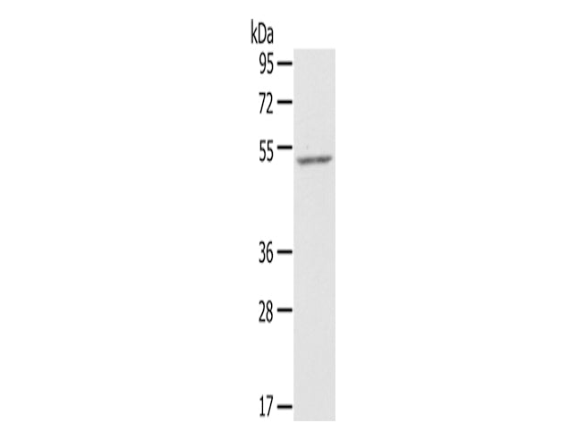 ZFP36L2 Polyclonal Antibody Store at -20°C - MSE Supplies LLC