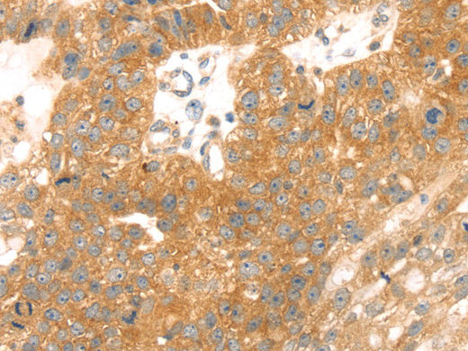TMEFF2 Polyclonal Antibody Store at -20°C - MSE Supplies LLC