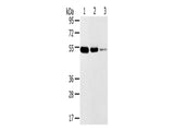 TMPRSS11F Polyclonal Antibody Store at -20°C - MSE Supplies LLC