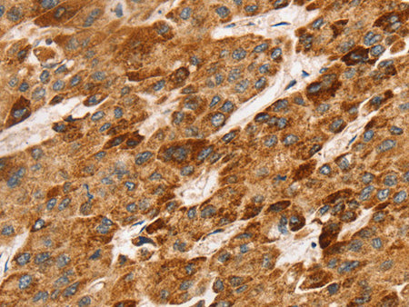 LTB Polyclonal Antibody Store at -20°C - MSE Supplies LLC