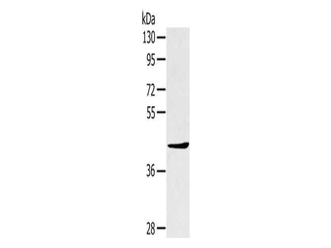 TNIP2 Polyclonal Antibody Store at -20°C - MSE Supplies LLC