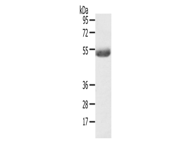 AGPAT6 Polyclonal Antibody Store at -20°C - MSE Supplies LLC