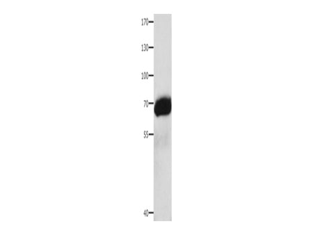 AFP Polyclonal Antibody Store at -20°C - MSE Supplies LLC