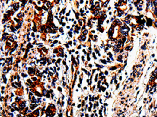 ACSBG2 Polyclonal Antibody Store at -20°C - MSE Supplies LLC