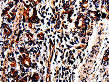ACSBG2 Polyclonal Antibody Store at -20°C - MSE Supplies LLC