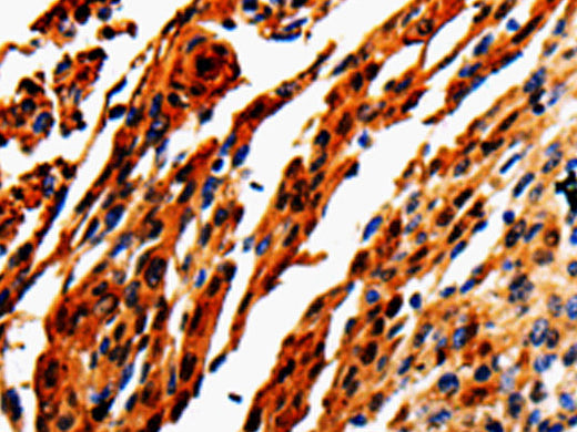 ADD1 Polyclonal Antibody Store at -20°C - MSE Supplies LLC