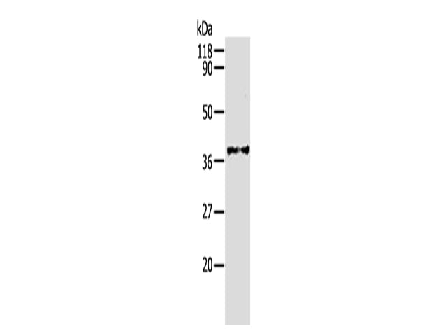 AKR1B1 Polyclonal Antibody Store at -20°C - MSE Supplies LLC