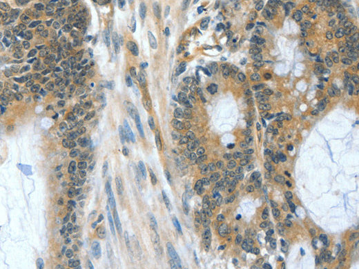 BAD Polyclonal Antibody Store at -20°C - MSE Supplies LLC