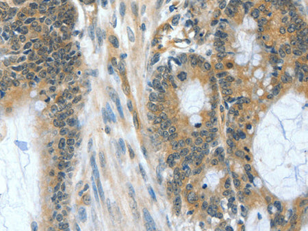 BAD Polyclonal Antibody Store at -20°C - MSE Supplies LLC