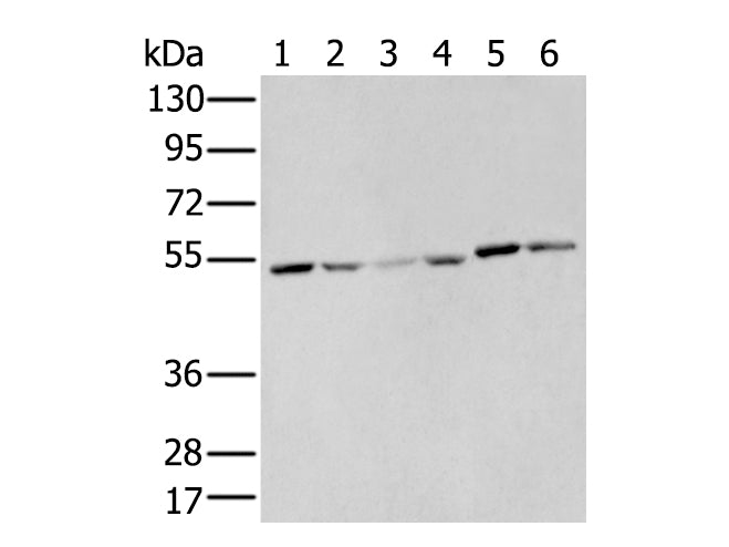 MMP1 Polyclonal Antibody Store at -20°C - MSE Supplies LLC