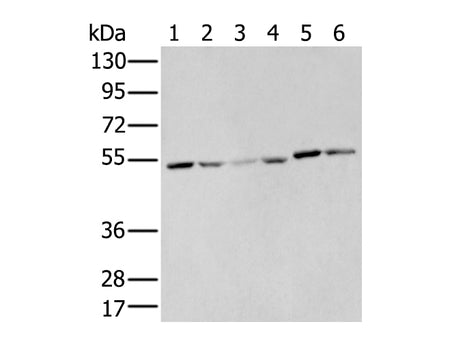 MMP1 Polyclonal Antibody Store at -20°C - MSE Supplies LLC