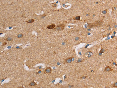TLR8 Polyclonal Antibody Store at -20°C - MSE Supplies LLC