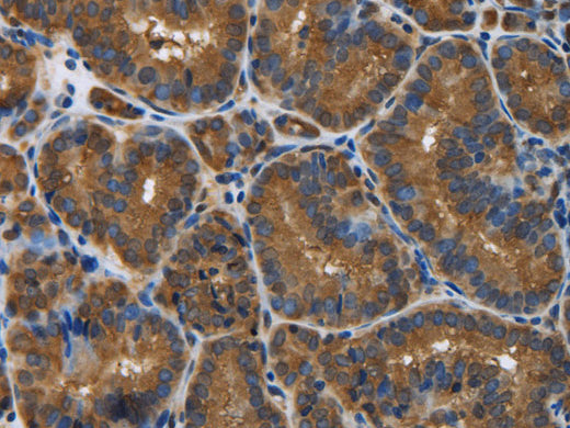 SNCG Polyclonal Antibody Store at -20°C - MSE Supplies LLC