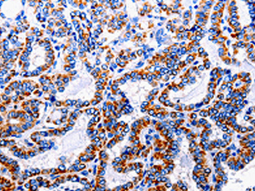 NFκB-p105 Polyclonal Antibody Store at -20°C - MSE Supplies LLC