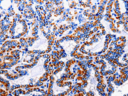 NFκB-p105 Polyclonal Antibody Store at -20°C - MSE Supplies LLC