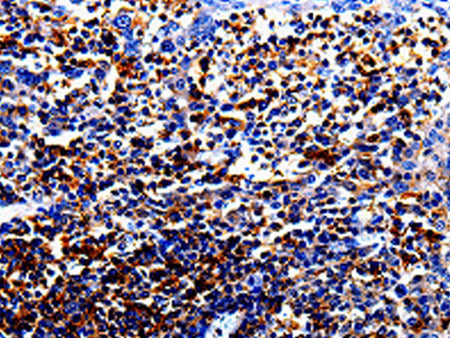 IL10RA Polyclonal Antibody Store at -20°C - MSE Supplies LLC