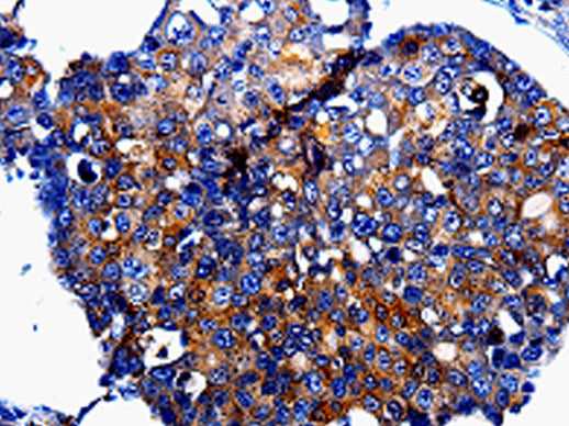 IL10RB Polyclonal Antibody Store at -20°C - MSE Supplies LLC