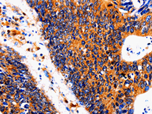 IL18BP Polyclonal Antibody Store at -20°C - MSE Supplies LLC