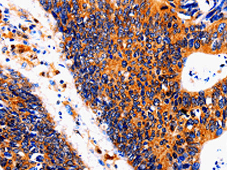 IL18BP Polyclonal Antibody Store at -20°C - MSE Supplies LLC