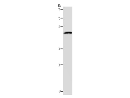 HTR2B Polyclonal Antibody Store at -20°C - MSE Supplies LLC