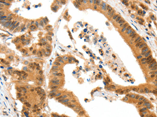 HTR3A Polyclonal Antibody Store at -20°C - MSE Supplies LLC