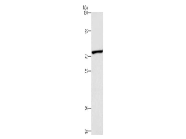 ABCB8 Polyclonal Antibody Store at -20°C - MSE Supplies LLC