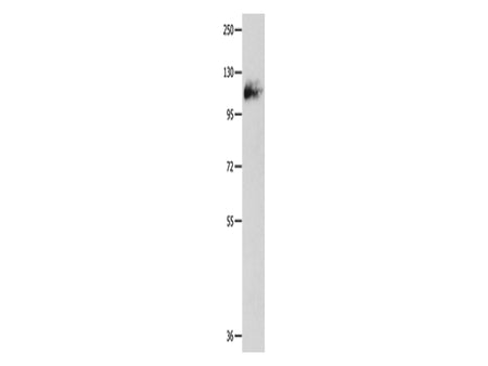 Amphiphysin I Polyclonal Antibody Store at -20°C - MSE Supplies LLC