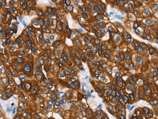 CK-8 Polyclonal Antibody Store at -20°C - MSE Supplies LLC