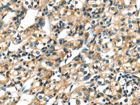 CK-17 Polyclonal Antibody Store at -20°C - MSE Supplies LLC