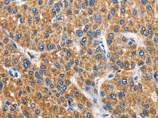APLNR Polyclonal Antibody Store at -20°C - MSE Supplies LLC