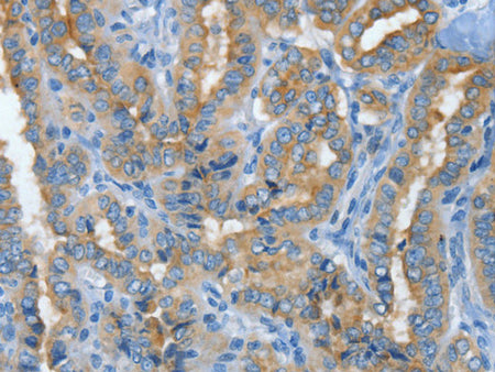 MUC15 Polyclonal Antibody Store at -20°C - MSE Supplies LLC