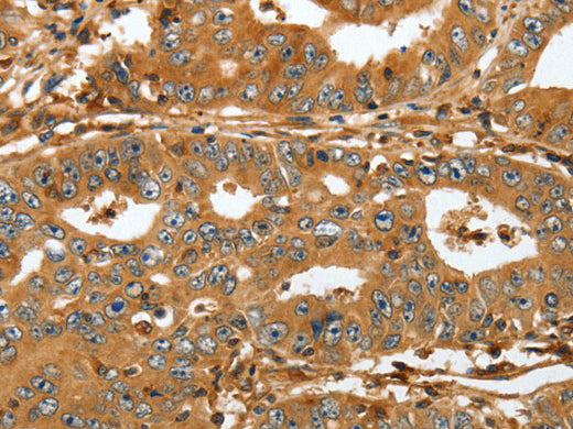 RAP1A Polyclonal Antibody Store at -20°C - MSE Supplies LLC
