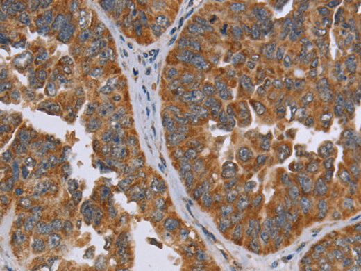 ADAMTS15 Polyclonal Antibody Store at -20°C - MSE Supplies LLC