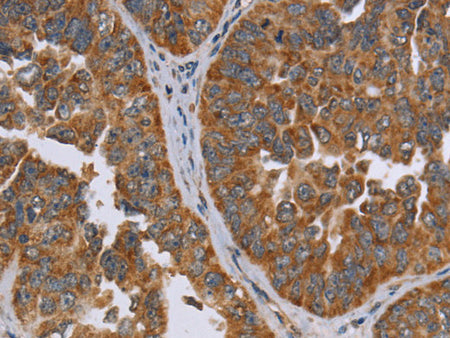 ADAMTS15 Polyclonal Antibody Store at -20°C - MSE Supplies LLC