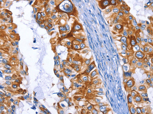ARRB1 Polyclonal Antibody Store at -20°C - MSE Supplies LLC