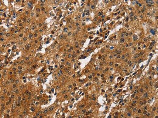 CREB2 Polyclonal Antibody Store at -20°C - MSE Supplies LLC