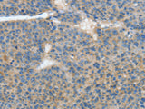 ATP4B Polyclonal Antibody Store at -20°C - MSE Supplies LLC