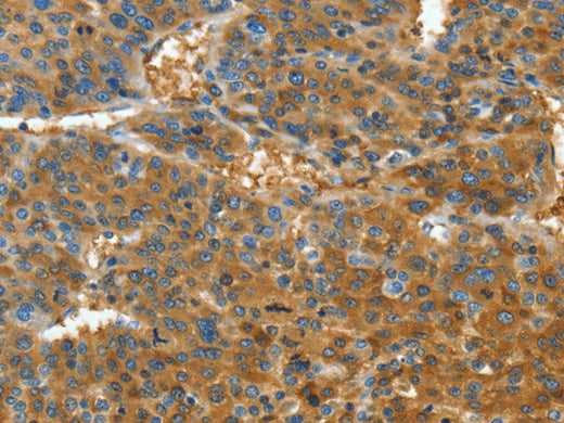 TNFSF13B Polyclonal Antibody Store at -20°C - MSE Supplies LLC