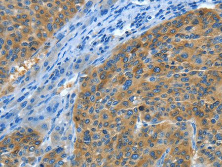Amphiphysin II Polyclonal Antibody Store at -20°C - MSE Supplies LLC